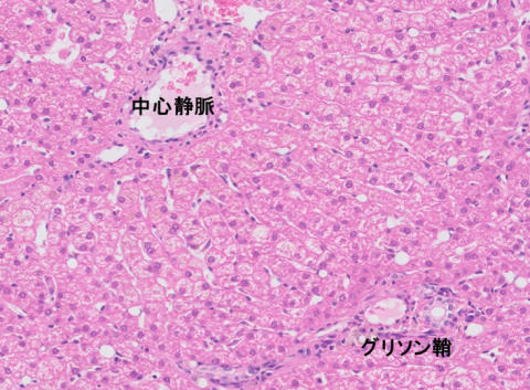liver-image002