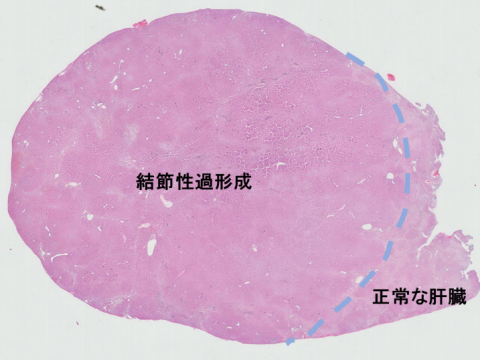liver-image004