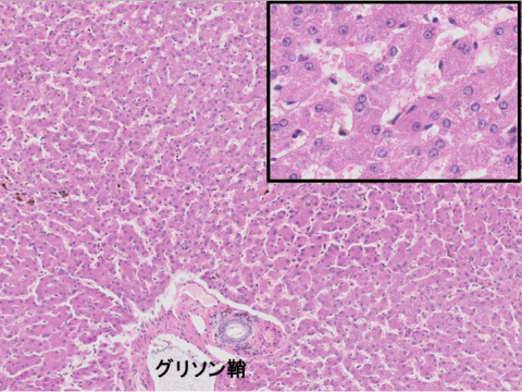 liver-image005