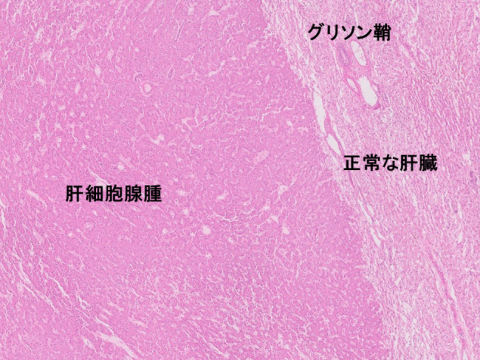 liver-image006