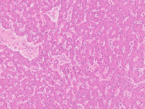 liver-image007