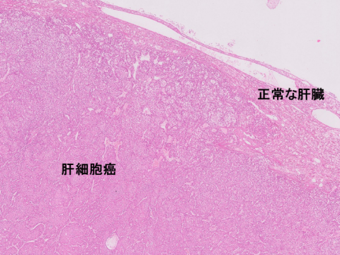 liver-image010