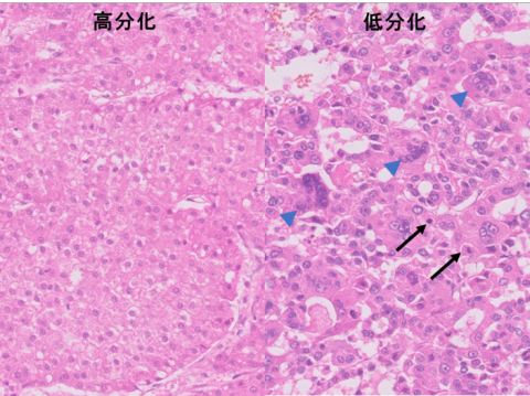 liver-image011