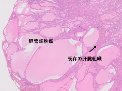 liver-image014