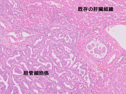 liver-image015