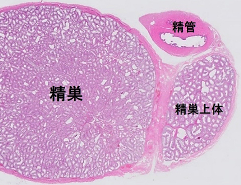 liver-image001