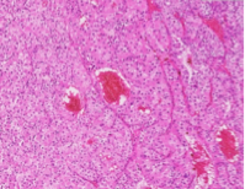 liver-image001