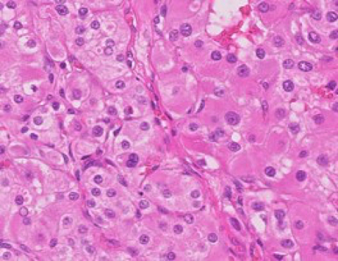 liver-image001