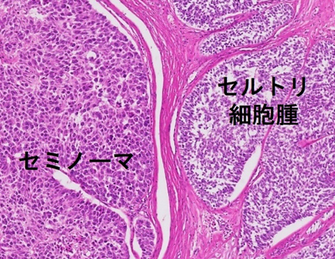 liver-image001