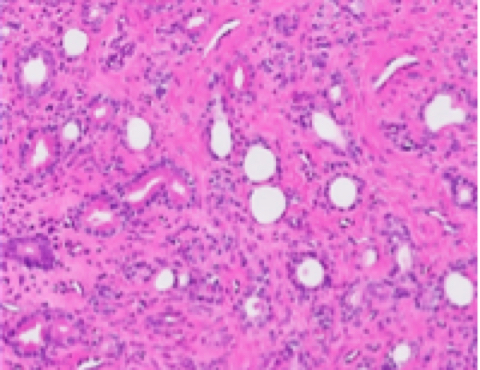 liver-image001