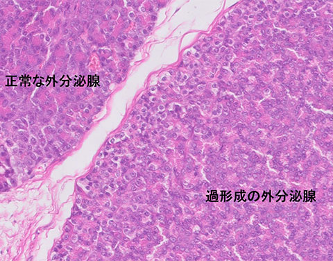 liver-image003