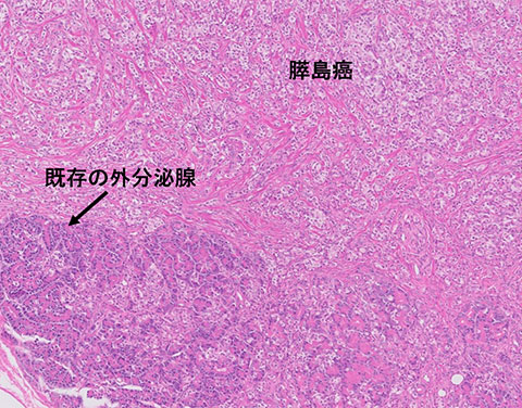 liver-image014