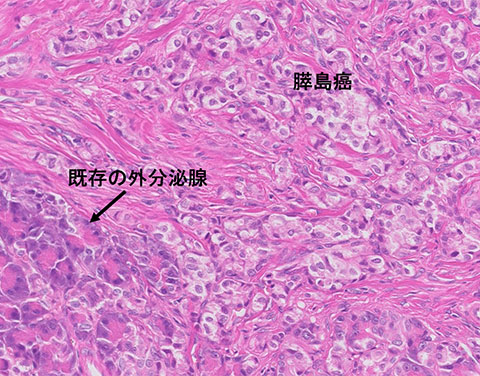 liver-image015