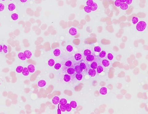parathyroid-image003